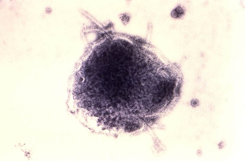 Measles outbreak in Dhorpatan under control