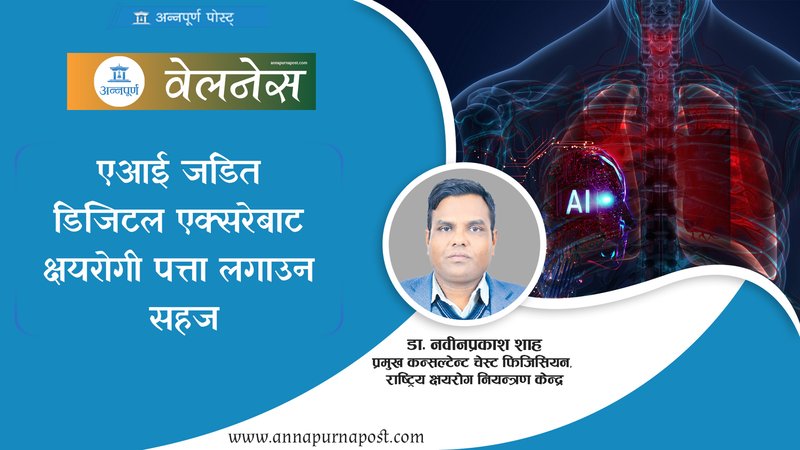 एआई जडित डिजिटल एक्सरेबाट क्षयरोगी पत्ता लगाउन सहज