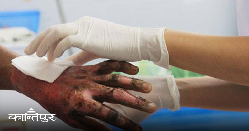 जाडोसँगै जलनका घटना बढे