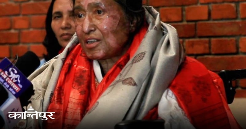 भदौ २४ मा जलेर घाइते भएकी रविलक्ष्मी चित्रकारको प्रश्न : सरकारले अपराधीलाई किन पक्राउ गरेन ?