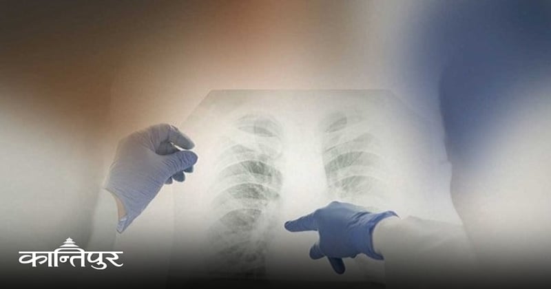 क्षयरोग र यसको व्यवस्थापनका लागि नेपालको प्रयास