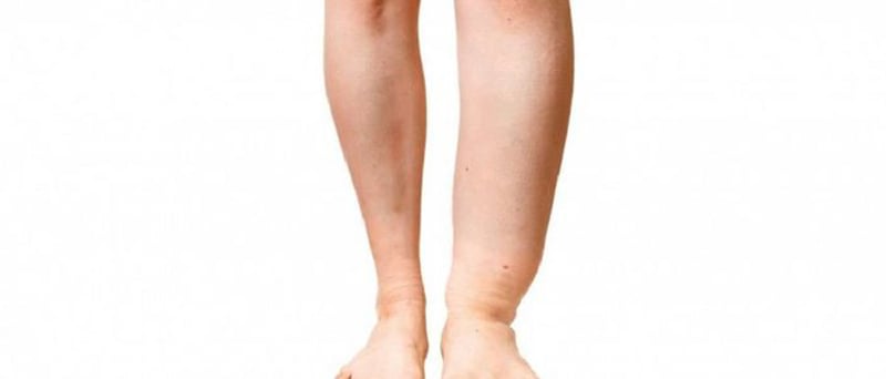 बाँकेमा हात्तीपाइलेविरुद्धको १० दिने औषधि सेवन अभियान