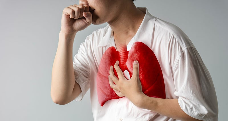 आज विश्व क्षयरोग दिवस, नेपालमा ६७ हजार क्षयरोगका नयाँ बिरामी फेला