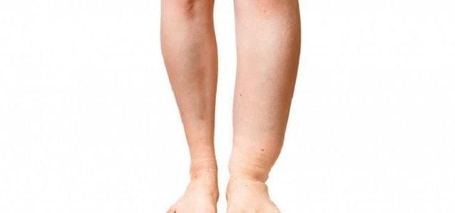 Over 400,000 people in Sarlahi to receive anti-elephantiasis medication