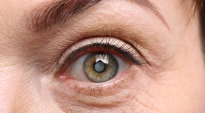 122 patients receive free cataract surgery in Jumla