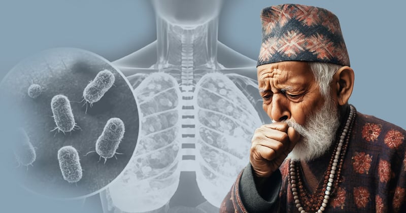 18 Bajura people die of tuberculosis in five years