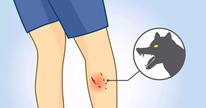 कुकुरको टोकाइबाट एकैदिन १७ जना घाइते