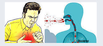 बाजुरामा क्षयरोगबाट १८ जनाको मृत्यु