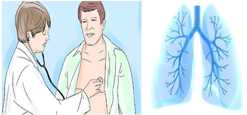 चितवनमा चार सय बढीमा क्षयरोगको सङ्क्रमण