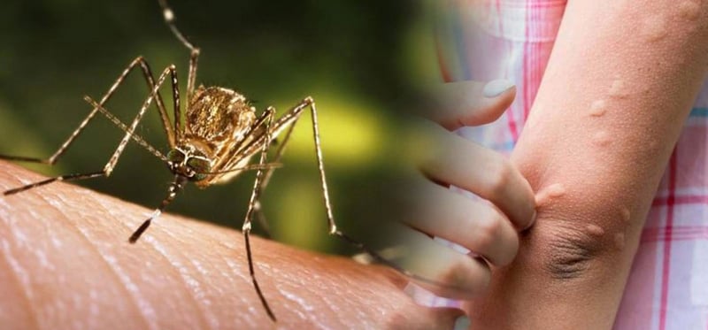 नवलपुरमा जापनिज इन्सेफ्लाइटिस विरुद्धको खोप दिन सुरु