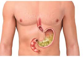 बालबालिकामा पनि हुनसक्छ ‘ग्यास्ट्रिक’