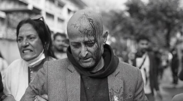 प्रहरीको लाठीचार्जबाट प्रदर्शनकारी घाइते, सिंहदरबार क्षेत्रमा सुरक्षा ‘हाइ अलर्ट’