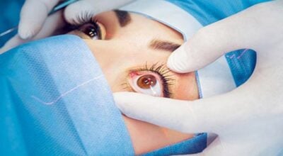 पौवादुङमाका ४७५ आँखा रोगीले गाउँघरमै पाए सेवा