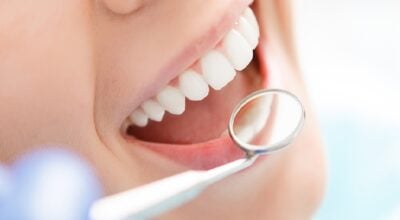 निःशुल्क दन्त शिविरबाट ३०५ जना लाभान्वित