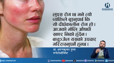 लुपस बाथले मिर्गौलादेखि मुटुसम्म असर गर्छ : डा.अरुणकुमार गुप्ता