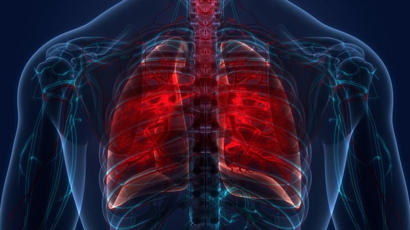 नेपालका ४२ प्रतिशत क्षयरोगी उपचार बाहिर