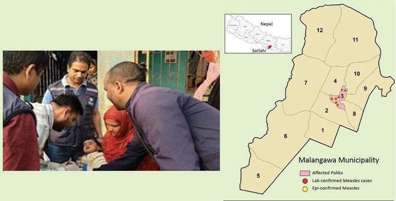 सर्लाहीका सात जनामा दादुरा संक्रमण पुष्टि