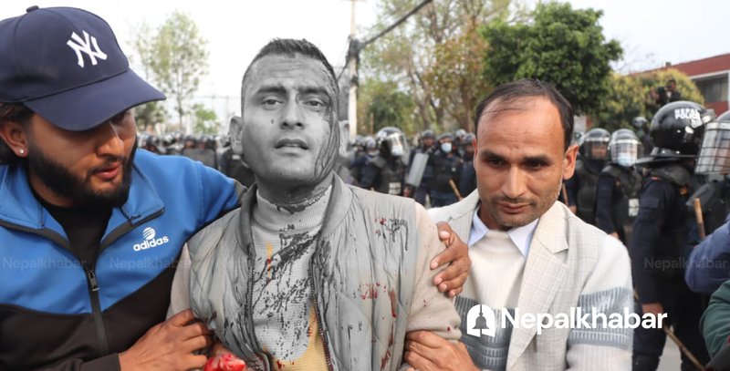 बबरमहलमा झडप, आन्दोलनकारीको निशानामा परे औषधि लिमिटेडका गार्ड (तस्बिरहरू)