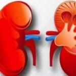 विश्व मिर्गौला दिवस: मिर्गौला स्वास्थ्यबारे सचेत रहन आग्रह