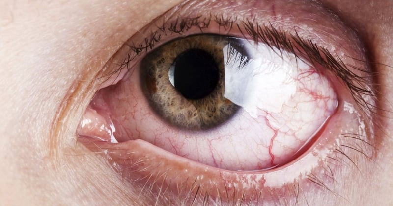 आँखा : संसार हेर्ने माध्यम मात्र होइन, शरीरको ऐना पनि हुन्