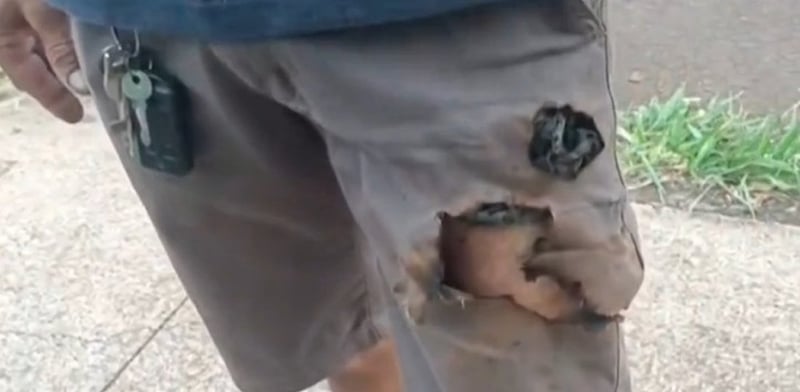 Man in Brazil Claims Exploding Mobile Phone Saved Him From Dog Attack