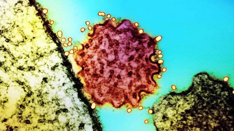 निपाह भाइरसको जोखिम बढेपछि सीमा नाकाहरुमा सरकारले थाल्यो निगरानी