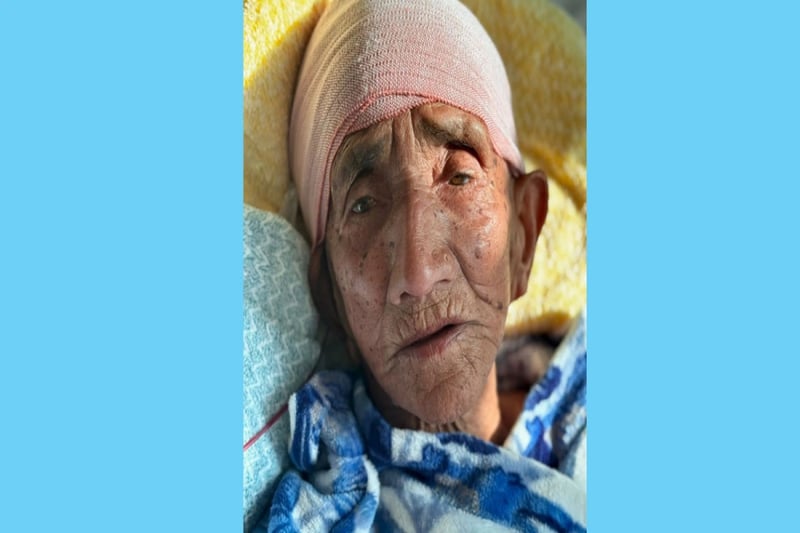 103-year-old woman undergoes successful brain surgery at Bir Hospital