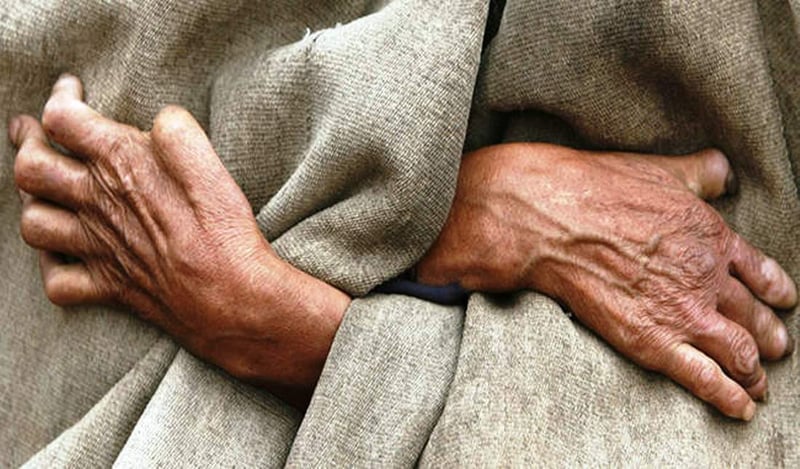 सुदूरपश्चिममा घटेन कुष्ठरोगको समस्या